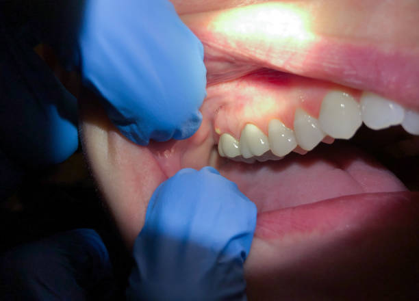 Best Emergency TMJ Treatment in St Simons, GA